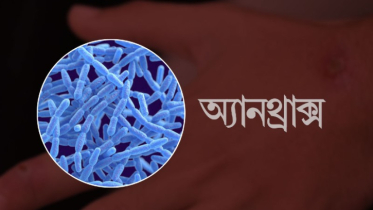 গাইবান্ধায় অ্যানথ্রাক্সের উপসর্গ নিয়ে নারীর মৃত্যু