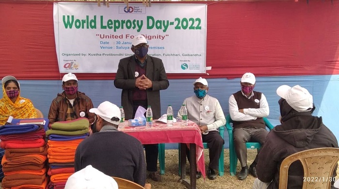 Leprosy a curable disease now, not a curse- health experts